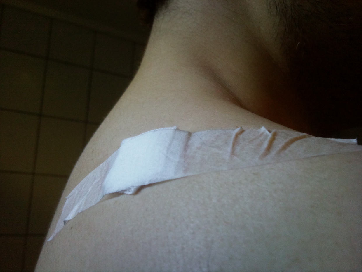 Av og til blir entusiasmen for stor og det går på helsa løs... :p  3 kortison sprøyter rett i ryggen... AU!